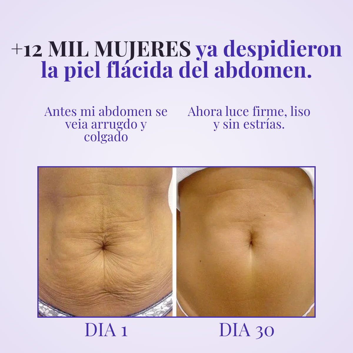 Lyviana - Crema Reactivadora de Colágeno Abdominal