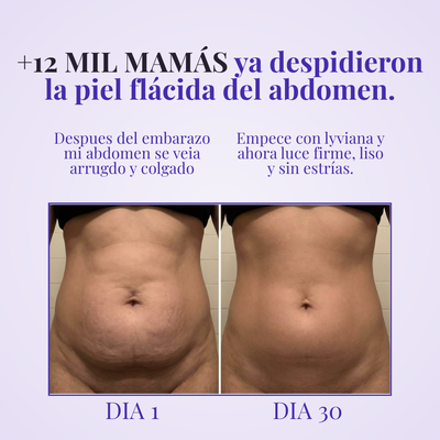 Lyviana - Crema Reactivadora de Colágeno Abdominal (POSTPARTO)