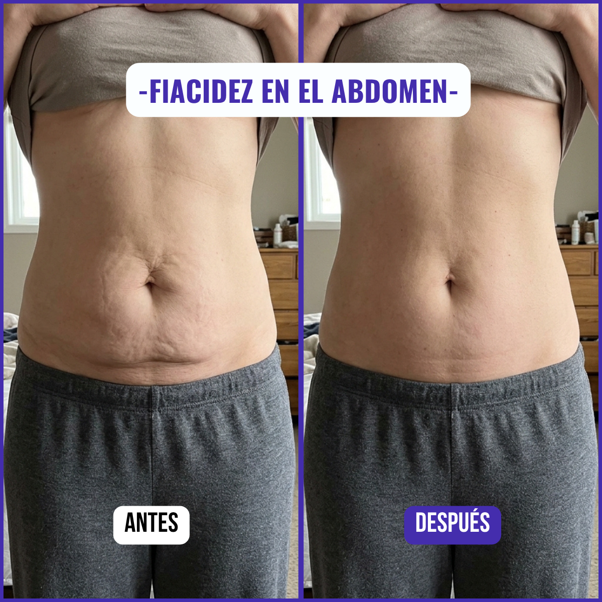 Lyviana - Crema Reactivadora de Colágeno Abdominal