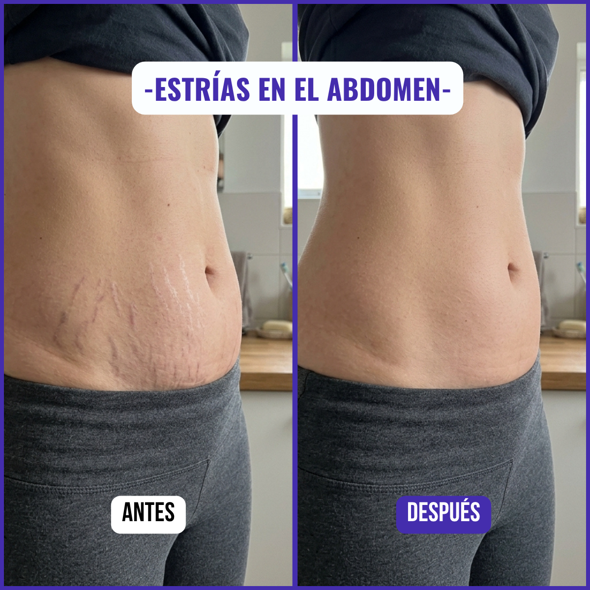 Lyviana - Crema Reactivadora de Colágeno Abdominal