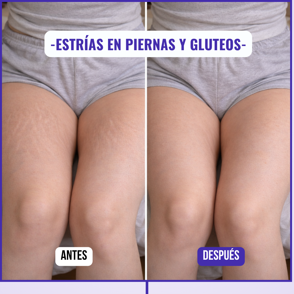 Lyviana - Crema Reactivadora de Colágeno Abdominal