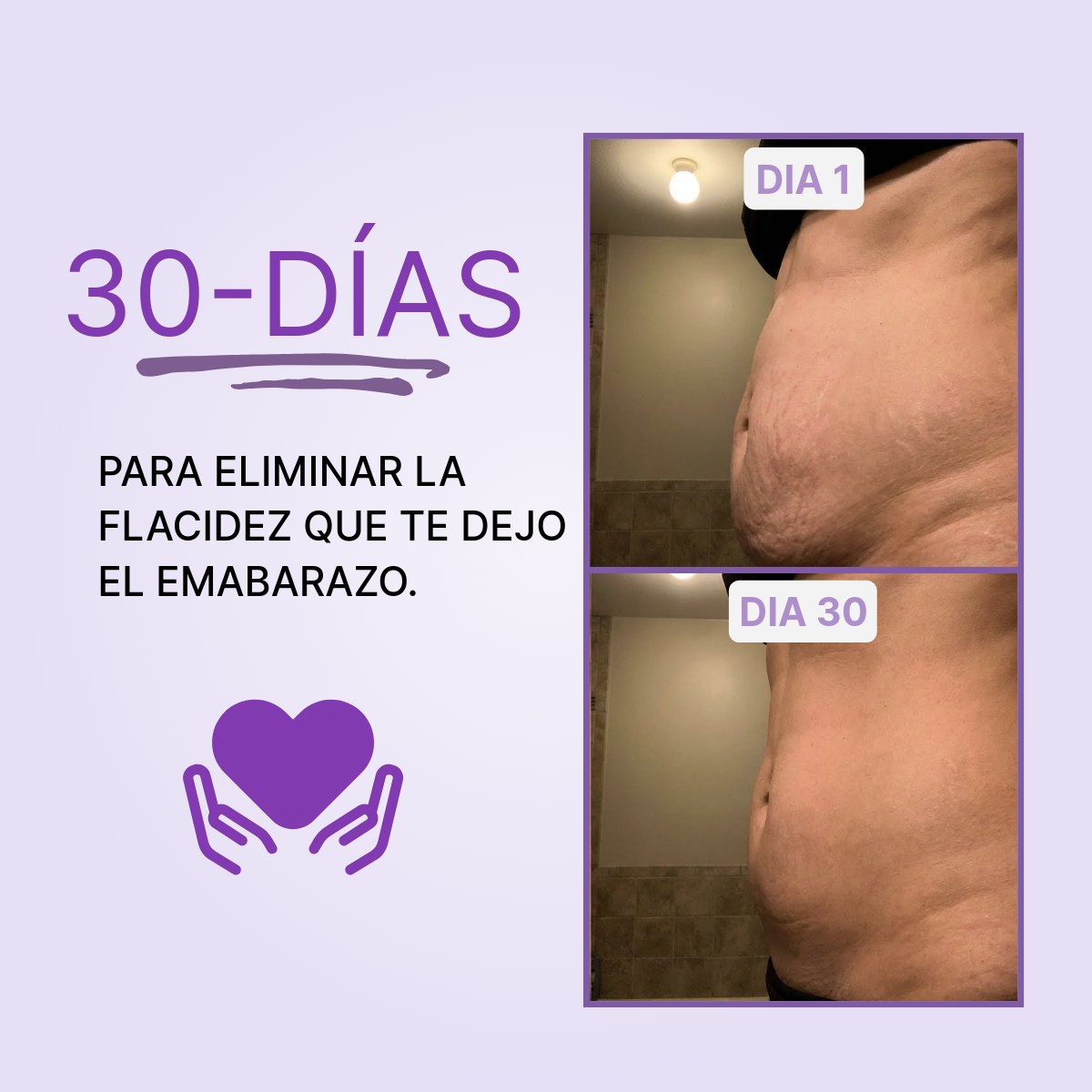Lyviana - Crema Reactivadora de Colágeno Abdominal (POSTPARTO)
